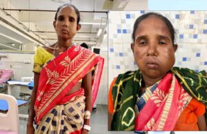 रायपुर में मेगा सुपर स्पेशलिटी हेल्थ कैंप से मिला नया जीवन, आयुष्मान कार्ड से हुआ बुधरी मड़कम का इलाज