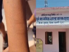 CG News: स्कूल में छात्र के काटने से 12 बच्चे प्रभावित, स्वास्थ्य विभाग ने शुरू की जांच
