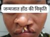 स्वास्थ्य सेवाओं की सफलता, सफल ऑपरेशन के बाद भीमे हेमला फिर मुस्कुराए