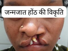 स्वास्थ्य सेवाओं की सफलता, सफल ऑपरेशन के बाद भीमे हेमला फिर मुस्कुराए